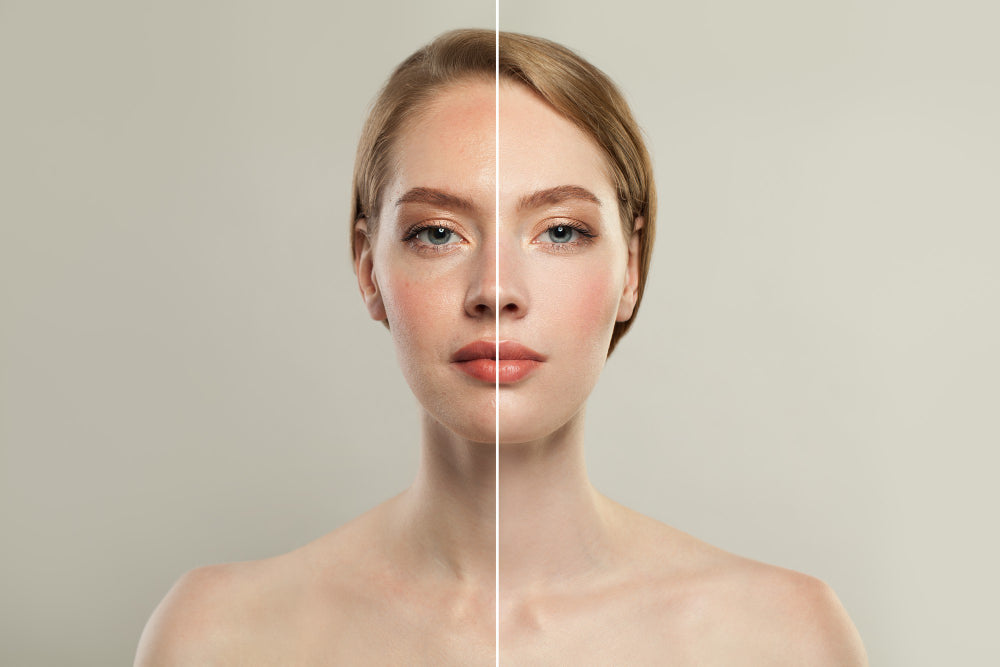 9 Reasons Why You Should Switch to Mineral Sunscreen