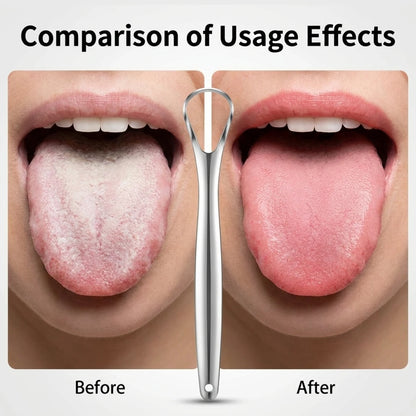 Tongue Scraper–Remove Tongue Coating, Bad Breath&Oral Odor,Fresh Breath Instantly, Reusable, Before/After Effect